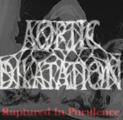 Aortic Dilatation : Ruptured in Purulence Aortic Dilatation : Ruptured in Purulence